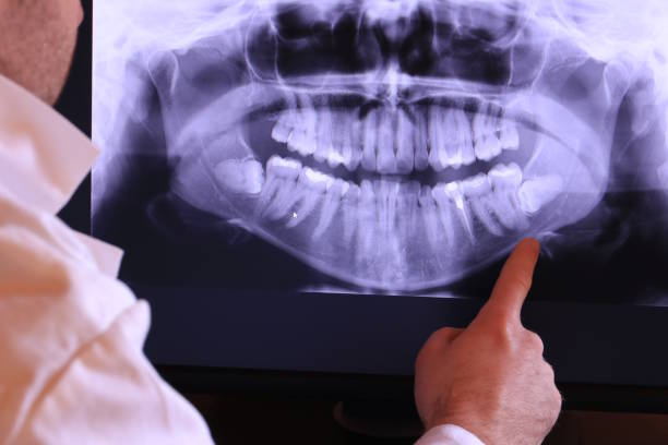 Best Emergency Treatment for Toothache in Petoskey, MI