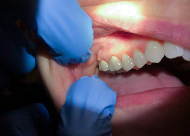 Best After-Hours Emergency Dentist in Petoskey, MI